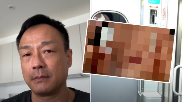 王喜自爆兩度懷疑被迷姦傷勢照片曝光 憶述下半身難以活動：我應該失禁