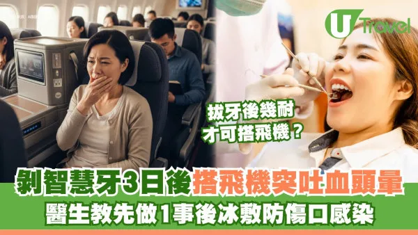 內地女子拔智慧牙3日後搭飛機突吐血頭暈！醫生建議剝牙後坐飛機至少隔多少天？