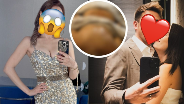 最性感港姐亞軍裸背驚插30針嚇窒網民 自揭受傷原因竟與歌手老公有關