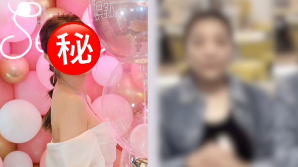 視帝老婆驚爆怪病纏身臉部突然腫脹 發炎病容照觸目驚心：搵唔到原因