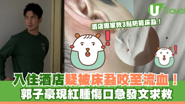 入住酒店疑被床蝨咬至流血！郭子豪現紅腫傷口發文求救 酒店專家教3點防範！