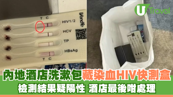 北上注意！內地酒店洗漱包藏染血HIV快測盒 檢測結果疑陽性 酒店最後咁處理