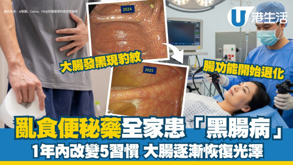 黑腸病致癌？亂食便秘藥全家大腸發黑現豹紋 逆轉黑腸症改5習慣康復