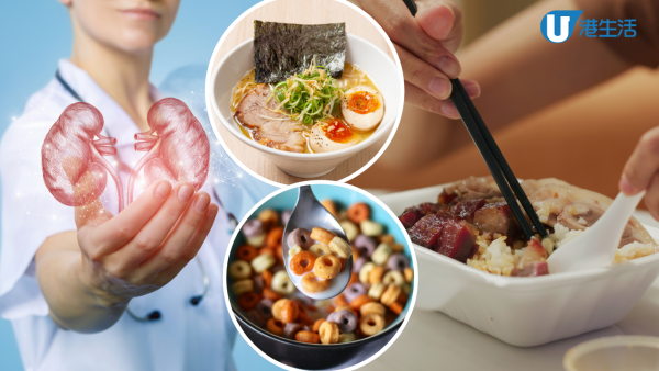 10大傷腎食物排名大公開！燒味飯排第4 一飲品高危