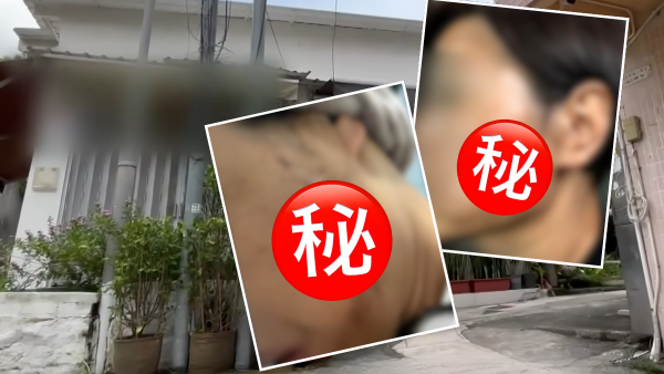 港媽貪平激光去斑出事慘變「黃黑斑面」苦主臉部潰爛竟因1事反收律師信