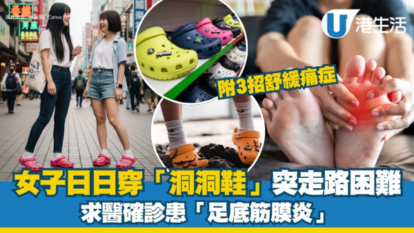 長期穿洞洞鞋惹禍？女子突走路困難求醫確診足底筋膜炎！3招紓緩痛症