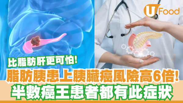 【胰臟癌】脂肪胰比脂肪肝更可怕！胰臟癌風險多6倍／半數癌王患者都有此症狀