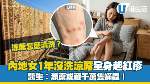 內地女1年沒清洗涼蓆 睡醒全身起紅疹 醫生︰涼蓆或藏千萬隻蟎蟲！