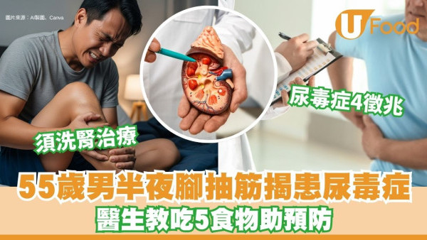 55歲男半夜瞓覺腳抽筋 揭患尿毒症須洗腎【附5食物預防半夜腳抽筋】