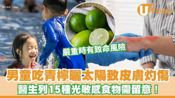 男童吃青檸後曬太陽 皮膚竟嚴重灼傷 醫生列15種光敏感食物需留意！