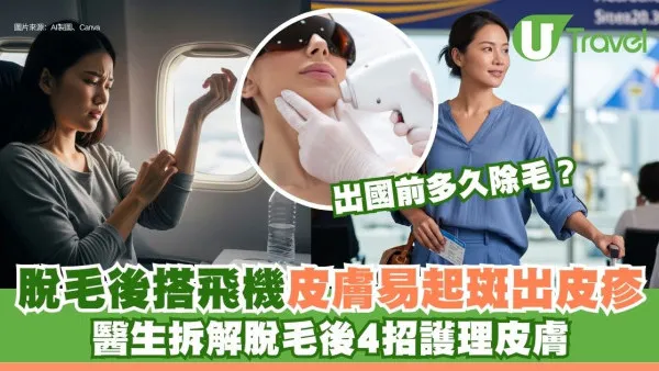 脫毛後搭飛機皮膚易起斑出皮疹 醫生拆解脫毛後4招護理皮膚