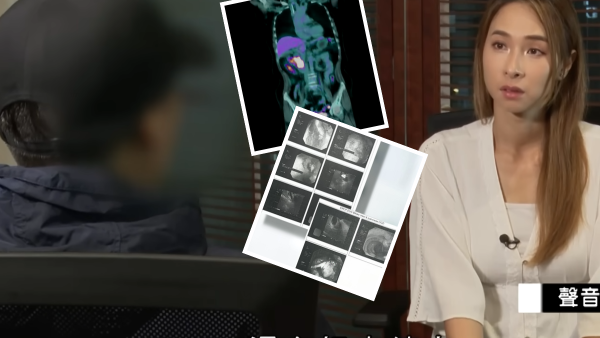 60歲癌母手術中離奇心臟停頓 家屬質疑醫療失誤 竟收到匿名信爆驚人內幕