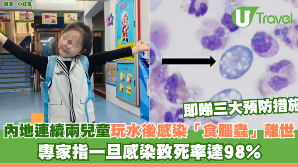內地連續兩名兒童玩水後感染「食腦蟲」死亡！專家指一旦感染致死率達98%