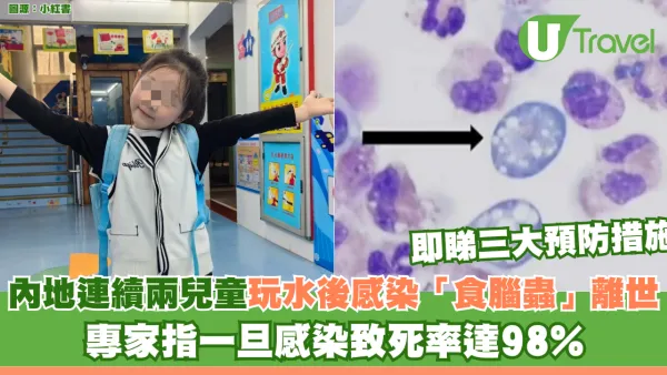 內地連續兩名兒童玩水後感染「食腦蟲」死亡！專家指一旦感染致死率達98%