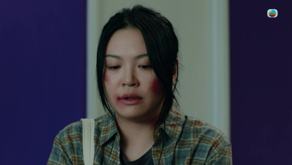 俠醫｜37歲麥皓兒增肥18磅「自毁顏值」 演基層家庭媽咪竟然冇人認得？