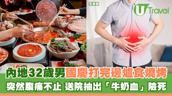 內地32歲男國慶打完邊爐食燒烤 突然腹痛不止 送院抽出「牛奶血」險死