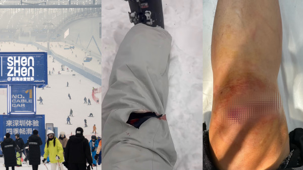 華發冰雪世界「見底」！港客滑雪重摔縫12針 怒轟：水泥地板肉眼可見