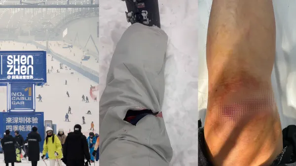 華發冰雪世界「見底」！港客滑雪重摔縫12針 怒轟：水泥地板肉眼可見
