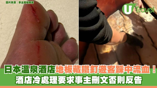 日本溫泉酒店地板藏鐵釘遊客踩中流血！酒店冷處理要求事主刪文否則反告