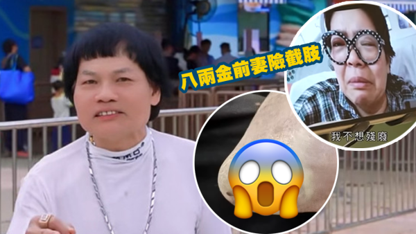 八兩金前妻誤信無牌中醫!腳部嚴重潰爛險截肢?受訪哭訴反被網民鬧爆:無知好可怕