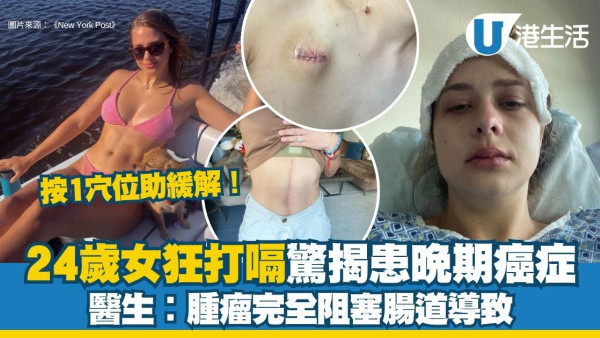 打嗝打不停?24歲護士狂打嗝驚揭患大腸癌三期 中醫教1穴位5分鐘可緩解!
