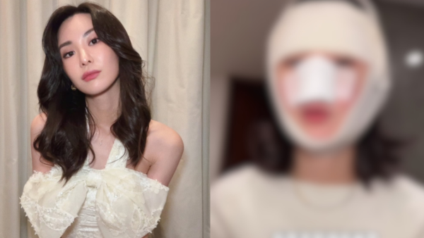 裕美拍片公開人生第一次韓國整容過程 親揭手術後三日面腫驚嚇真面目