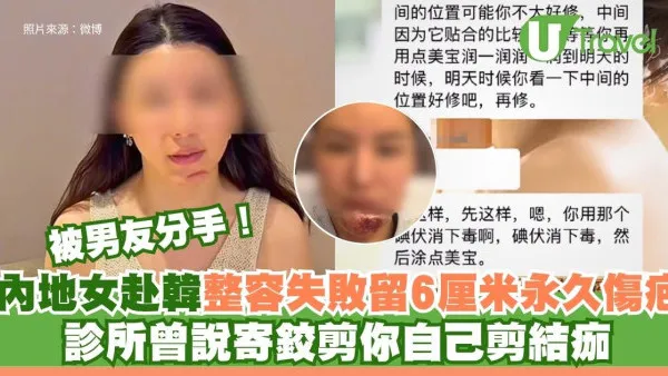 內地女赴韓整容失敗留6厘米永久傷疤被男友分手！診所曾說寄鉸剪你自己剪結痂