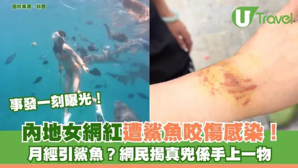 事發一刻曝光！內地女網紅遭鯊魚咬傷感染！ 月經引鯊魚？網民揭真兇係手上一物