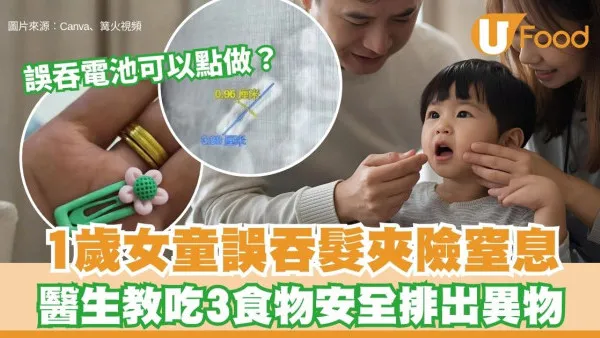 誤吞異物自救法︱1歲女童誤吞3cm髮夾險窒息 醫生教吃3食物急救 即刻安全排出異物