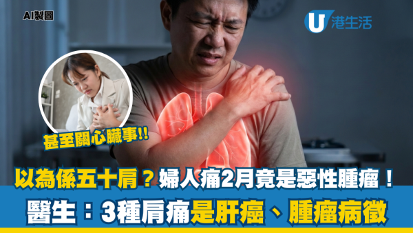 以為五十肩？56歲婦肩痛2個月驚揭生腫瘤！醫生警告：出現這 3 種肩痛恐是「癌症轉移」