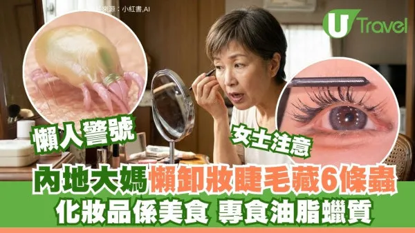慎入！內地大媽懶卸妝眼極痕求醫 睫毛藏6條蟎蟲啃化妝品嚇到傻