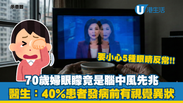中風先兆｜70歲婦眼矇以為老花？求醫揭腦中風先兆！醫生：40%患者病發前有5大眼睛不適
