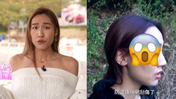 東張女神黎寬怡追訪變態裸男險毀容！鐵網刮面現長血痕傷勢曝光需打破傷風