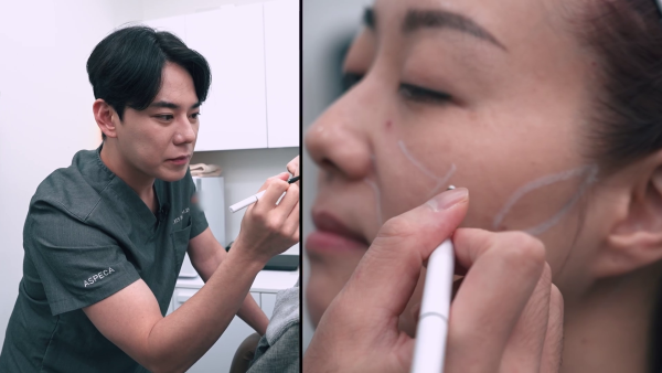 韓國水光針｜何依婷直擊史上最痛醫美！手打麗珠蘭黑盒被指痛過生仔