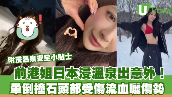前港姐黃婉恩日本出意外！浸溫泉暈倒撞石頭破血流 附浸溫泉安全小貼士