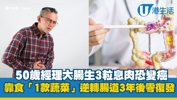 大腸癌︱50歲經理大腸生3粒息肉恐變癌 靠食「1款蔬菜」逆轉腸道 3年後腸道超靚兼零復發