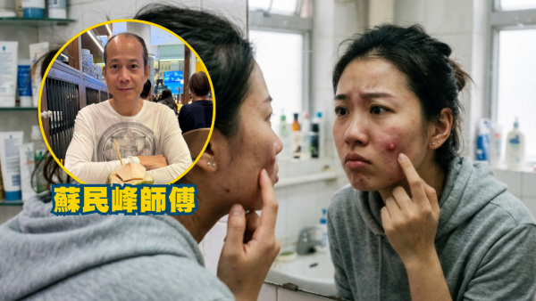 蘇民峰面相｜呢個位生暗瘡=有第三者？蘇民峰：長痘位置揭示感情危機 7大重災區要小心！