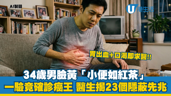 胰臟癌｜34歲男「小便如紅茶」以為肝出事？體重暴跌8kg揭確診癌王！醫生拆解：23個隱蔽症狀 易口渴是警號