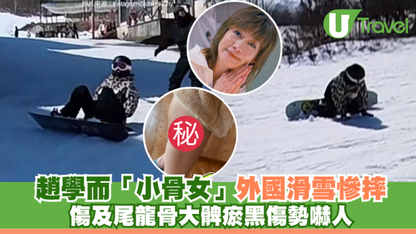 趙學而外國滑雪被老公分心慘摔 尾龍骨受傷大髀瘀黑 慨嘆：玩完就要還