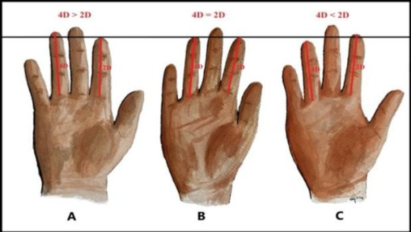 手指比例能預測IQ高低？成功人士手指有一特徵！醫生：O指短面對健康風險較高