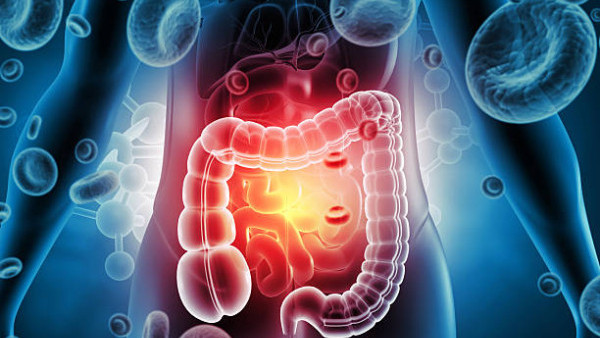 以為無咁黑仔？50歲婦大腸癌拒做手術！僅5個月惡化轉移肝臟 醫生嘆：絕非特例