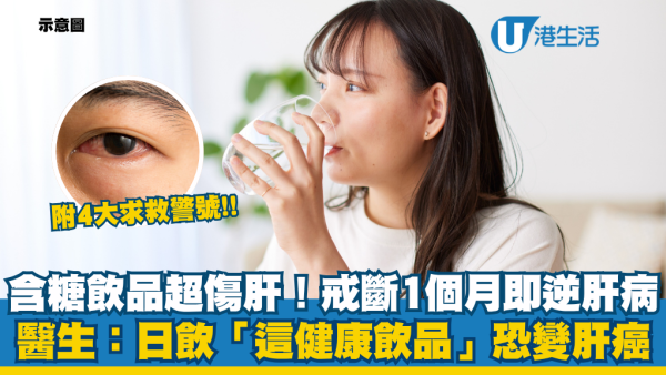 脂肪肝｜日飲這款健康飲品恐變肝癌？醫生教一招1個月逆轉脂肪肝！附4大肝病先兆：手掌變紅要留神