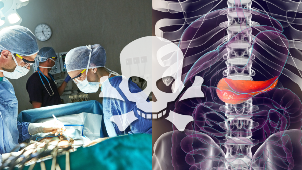 40歲男不煙不酒患急性胰臟炎！醫生驚見「黃色血液」揭1種健康食物惹禍