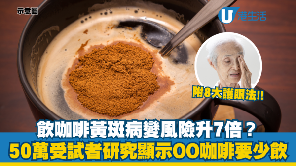 飲咖啡黃斑病變風險勁升7倍？研究結果：一類咖啡應少飲 醫生教8大護眼預防法