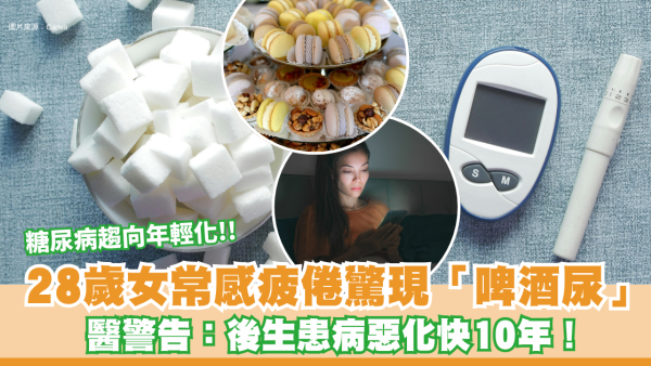 糖尿病年輕化危機｜28歲女常感疲倦驚現「啤酒尿」 醫警告：後生患病惡化快10年！