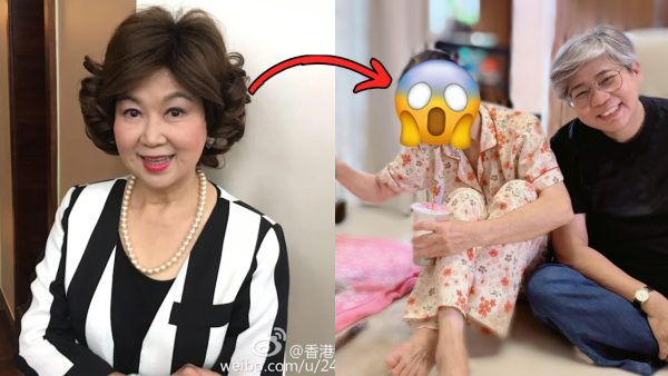 朱咪咪罕見無戴假髮真面目曝光！近照揭蒼老狀態骨瘦如柴嚇窒網民