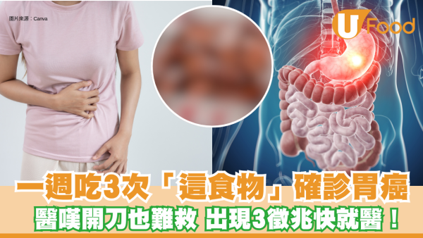 胃癌｜40歲女一週吃3次「這食物」確診胃癌 醫嘆開刀也難救 出現3徵兆快就醫！