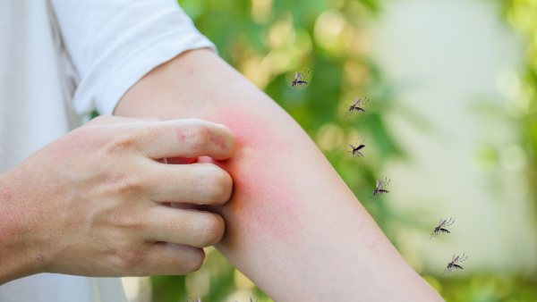 今年暴雨季提前！厄爾尼諾恐引爆史詩級蚊患 專家警告：呢幾個月高危