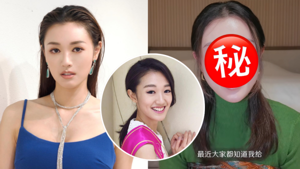 張寶兒近照驚見眼距愈黐愈埋好詭異！入行10年進化史極厚雙眼皮嚇窒網民