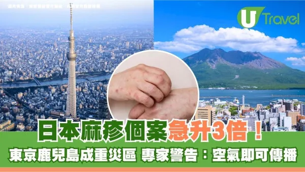 遊日注意！日本麻疹個案急升3倍！東京鹿兒島成重災區 專家警告：空氣即可傳播